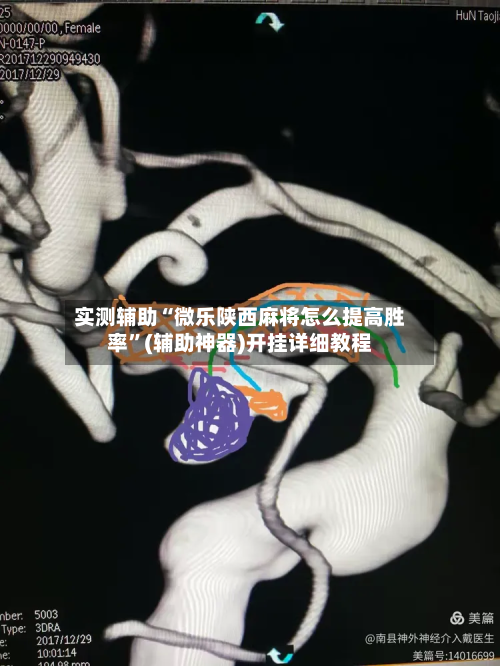 实测辅助“微乐陕西麻将怎么提高胜率	”(辅助神器)开挂详细教程-第1张图片