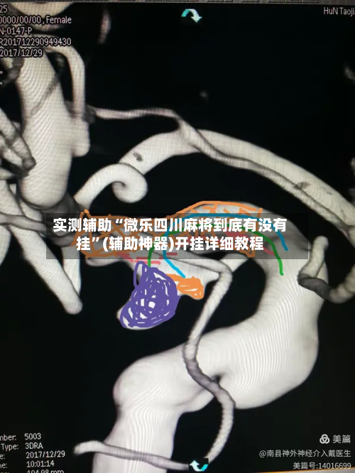 实测辅助“微乐四川麻将到底有没有挂	”(辅助神器)开挂详细教程-第1张图片