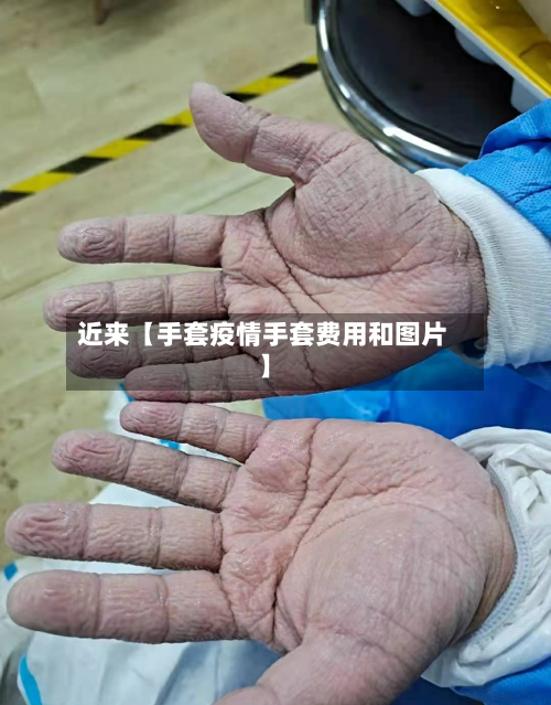 近来【手套疫情手套费用和图片】-第1张图片